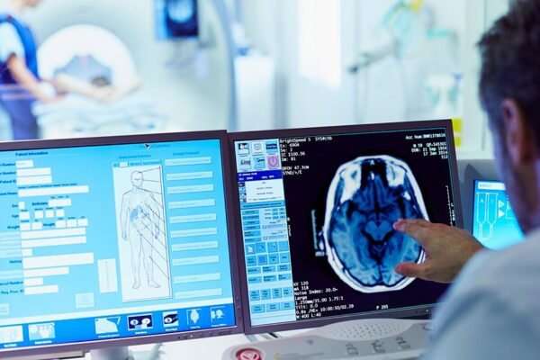 accident vascular cerebral