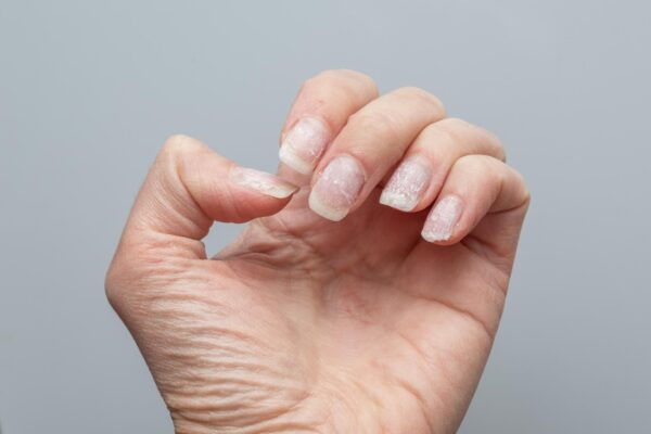 Unghii fragile după manichiuri repetate: cum reduci agresiunile cosmetice